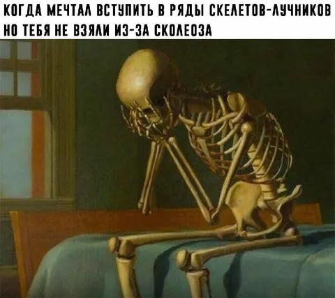 Скелет не взяли в лучники
