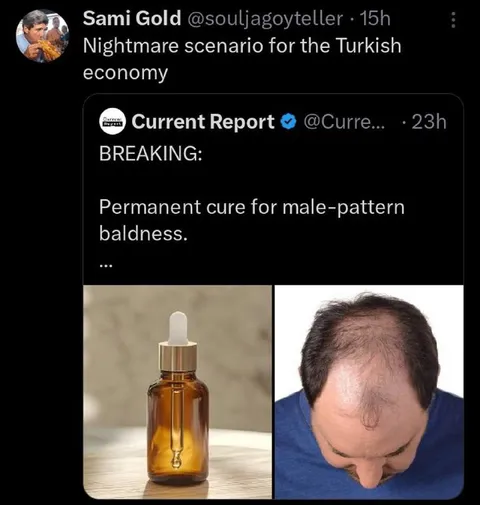 Permanent Cure for Baldness