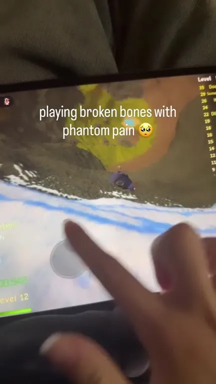 Playing Broken Bones With Phantom Pain