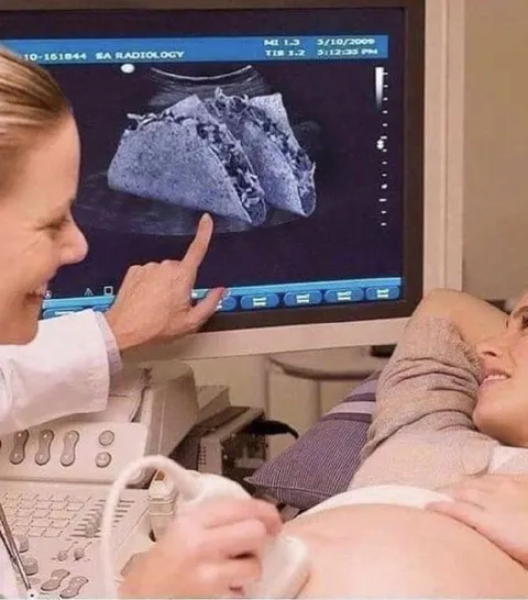 Неожиданное УЗИ