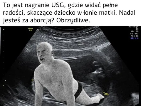 Skaczące dziecko na USG