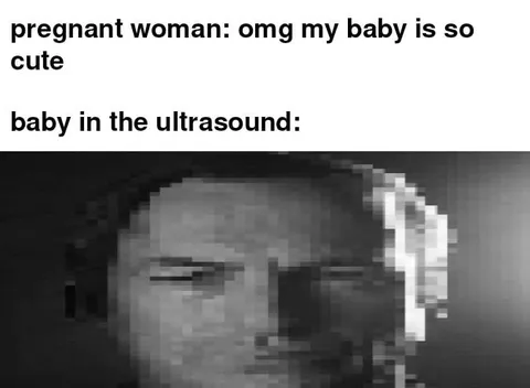 Baby in the Ultrasound