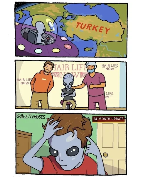 Alien Gets Hair Transplant in Turkey
