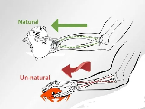 Natural Versus Un-natural Leg Anatomy
