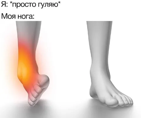 Просто погулять с больной ногой