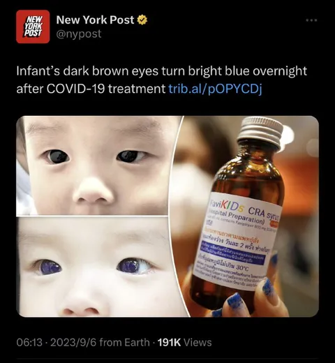 Infant’s Eyes Turn Blue Overnight