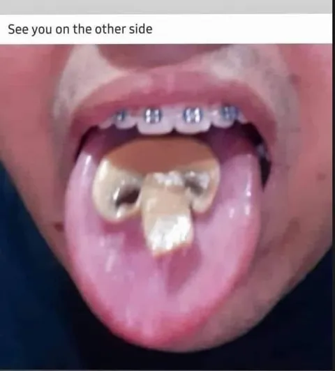 See You on the Other Side