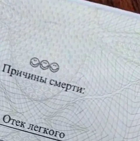Причины смерти: отек легкого