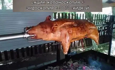 Акция на колоноскопию и эндоскопию