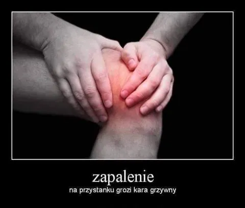 Zapalenie na przystanku