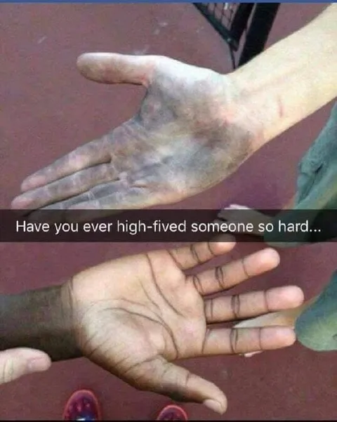 High-Fived Too Hard