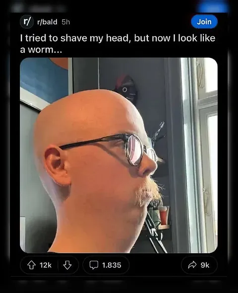 Shaved Head Looks Like a Worm