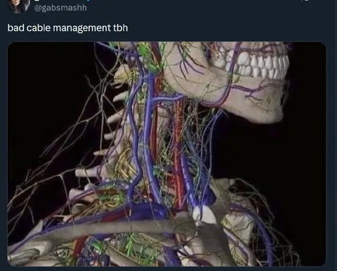Bad Cable Management Anatomy