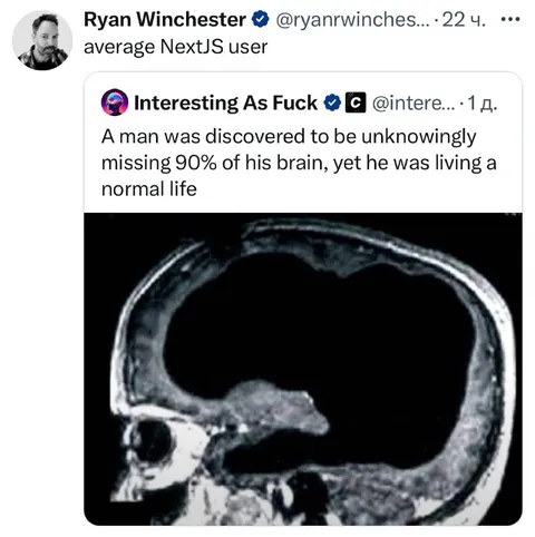 Average NextJS User Brain Scan