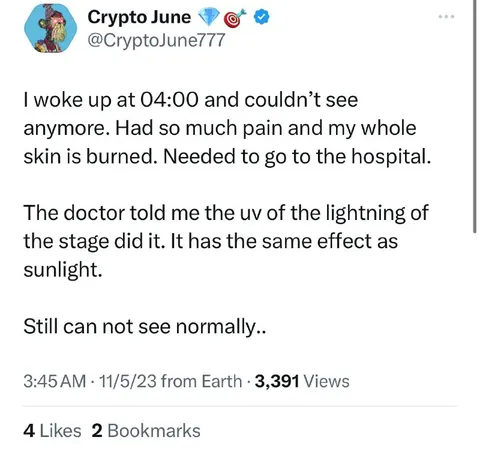 Concert UV Burn Hospital Joke