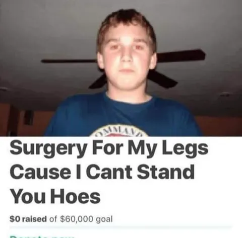 Surgery for My Legs