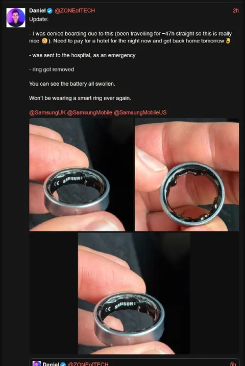 Swollen Smart Ring Battery