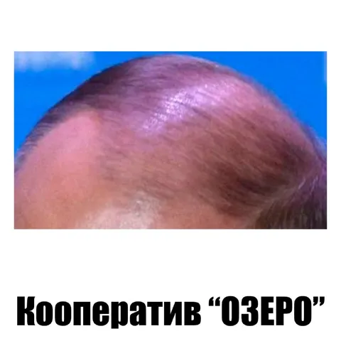 Кооператив «Озеро»