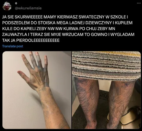 Kula do kąpieli i włochate nogi