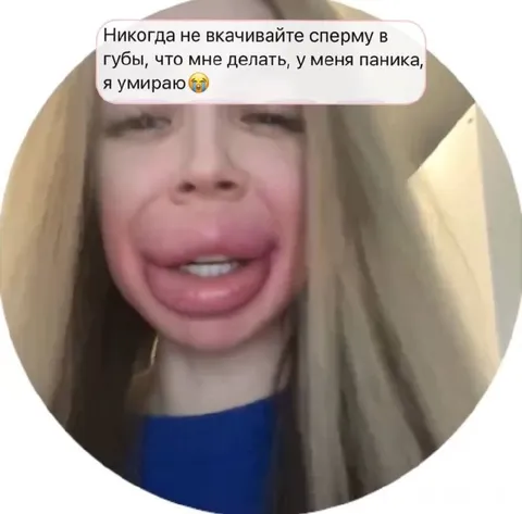 Паника после укола в губы