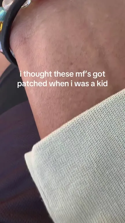 I Thought These Got Patched