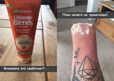 Возможно, крем поможет?