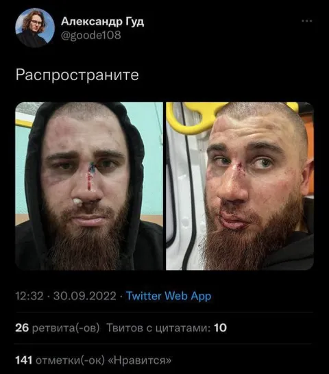Распространите фото побитых братьев