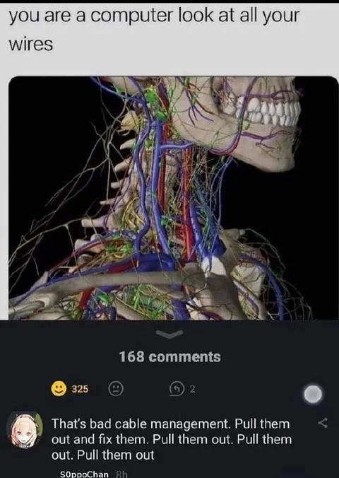 Bad Cable Management