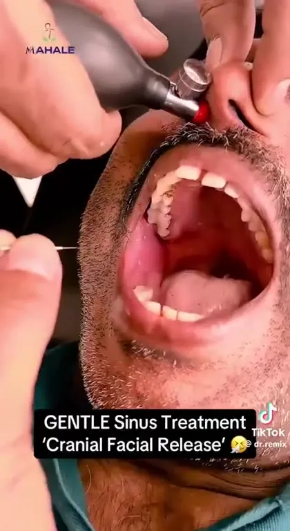 Gentle Sinus Treatment Gone Wrong