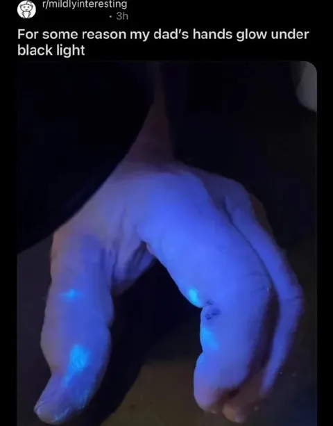 Dad's Hands Glow Under Black Light