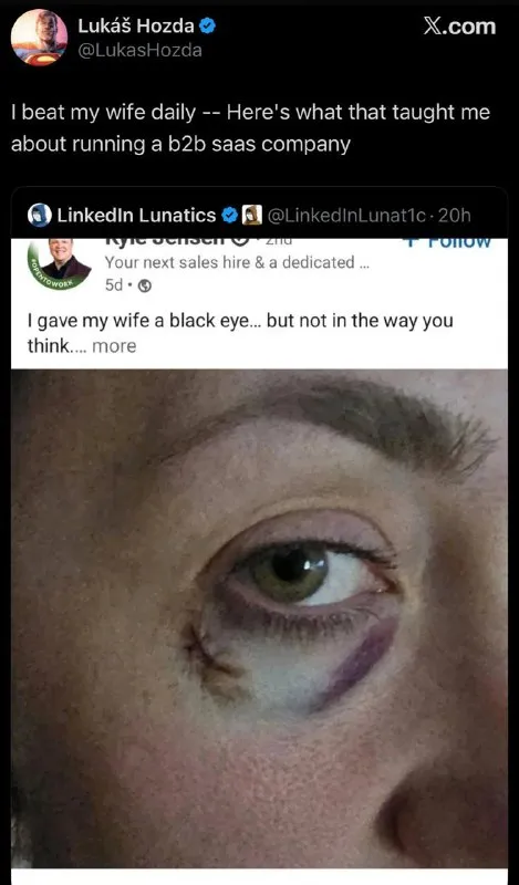 Black Eye Business Lesson