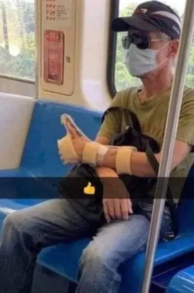 Пассажир с гипсом в метро