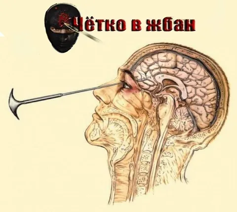 Пётка в жбан