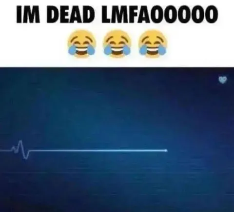 IM DEAD LMFAOOOOO EKG