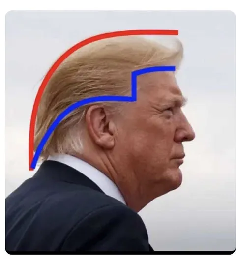 Трамп и странная линия волос