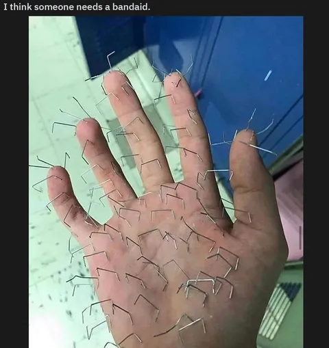 Someone Needs a Bandaid