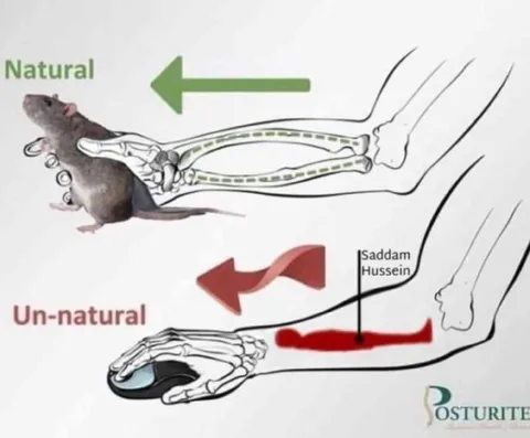 Natural Versus Un-natural Foot Posture
