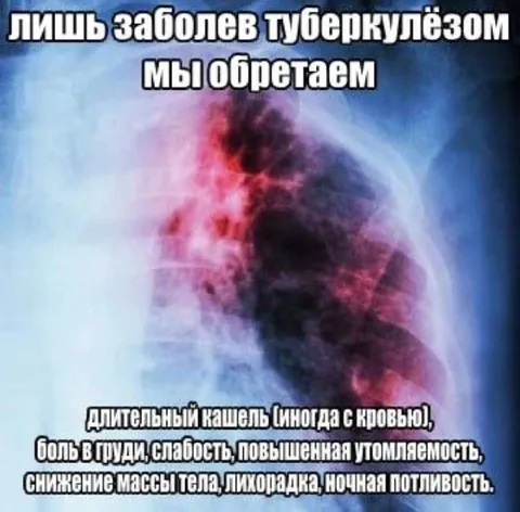 Лишь заболев туберкулёзом