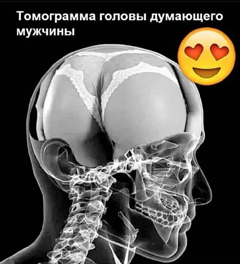 Томограмма головы думающего мужчины