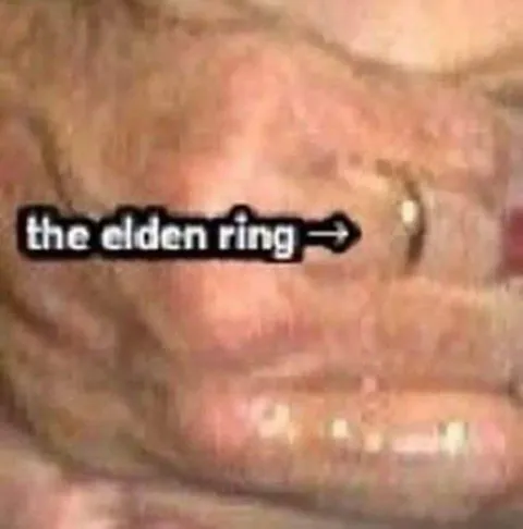 The Elden Ring Tooth