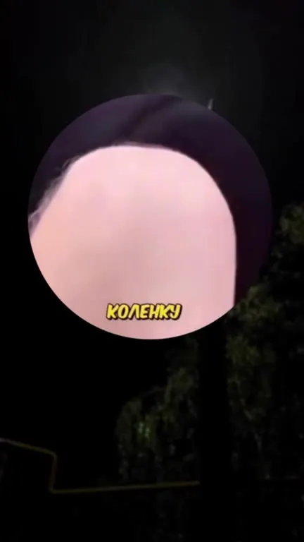 КОЛЕНКУ ТОЛЬКО ПОСТАВЬТЕ