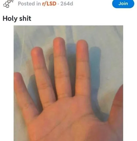 Holy Shit Hand Reaction