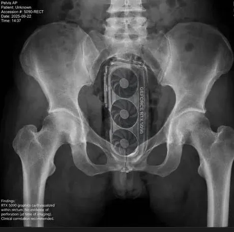 RTX 5090 Rectal X-Ray