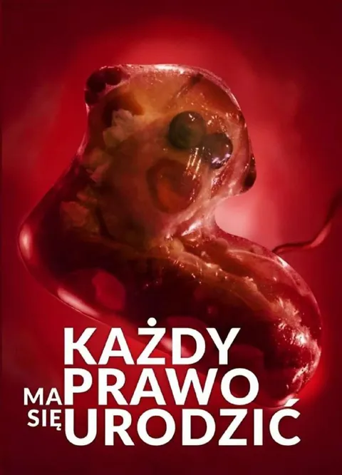 Każdy ma prawo się urodzić