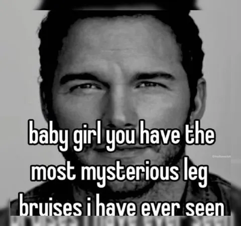 Mysterious Leg Bruises