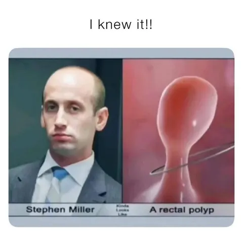 Stephen Miller and a Rectal Polyp