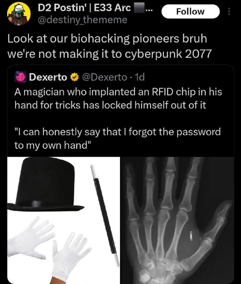 Forgot the Password to His Hand